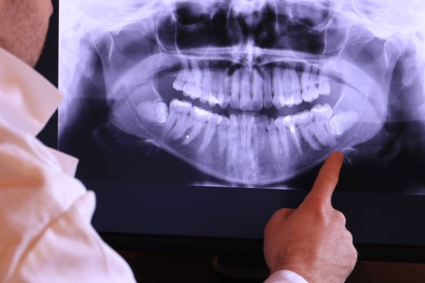 Best Chipped Tooth Repair Near Me  in Wmette, IL